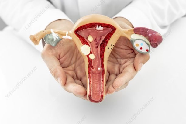 Gynaecological diseases, conceptual image.